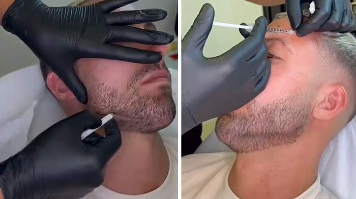 Mattia Carnessali, în vizită la estetician. La ce intervenție a apelat fosta ispită de la Insula Iubirii