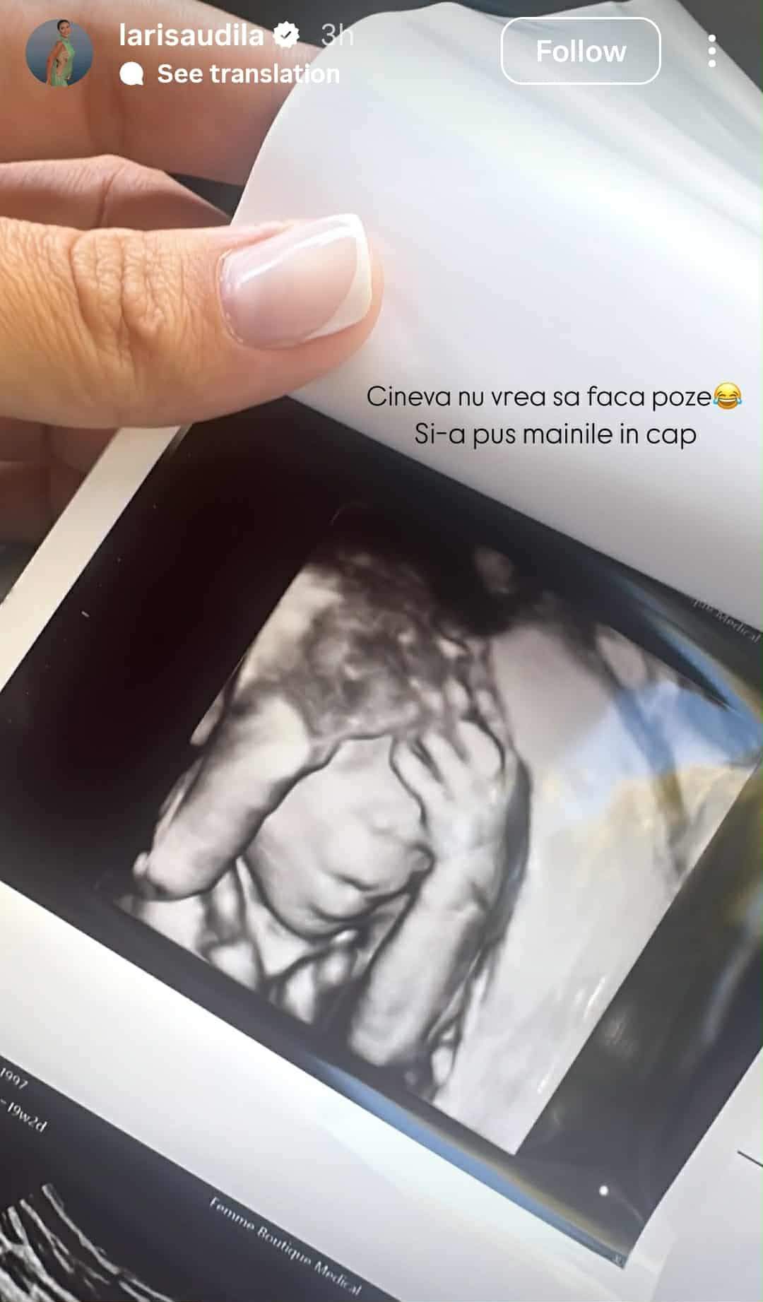 fiica Larisei Udilă