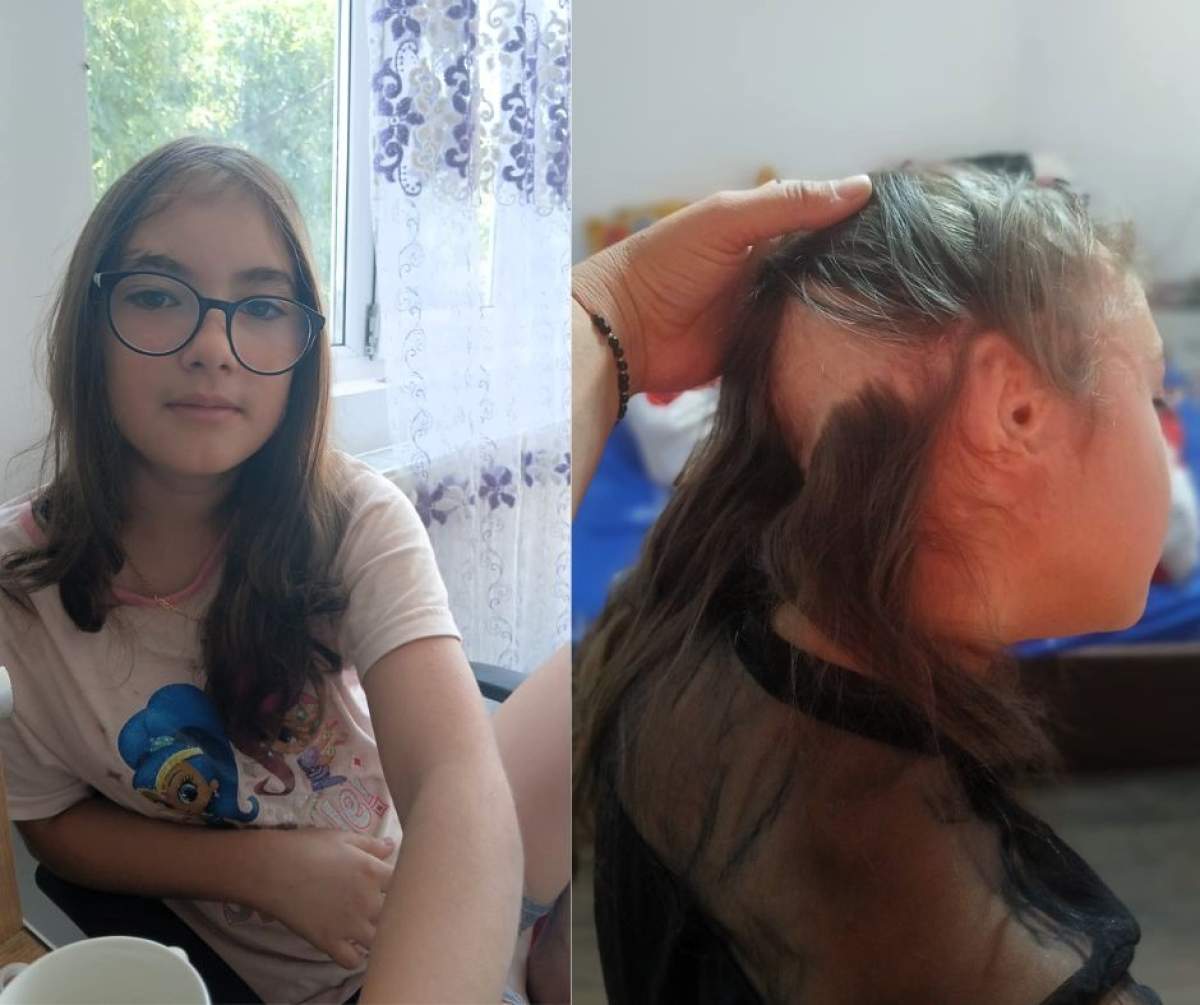 Apel umanitar: Andreea, o fetiță de 11 ani care a fost mutilată de câini, are nevoie de noi pentru a-și reface urechea!