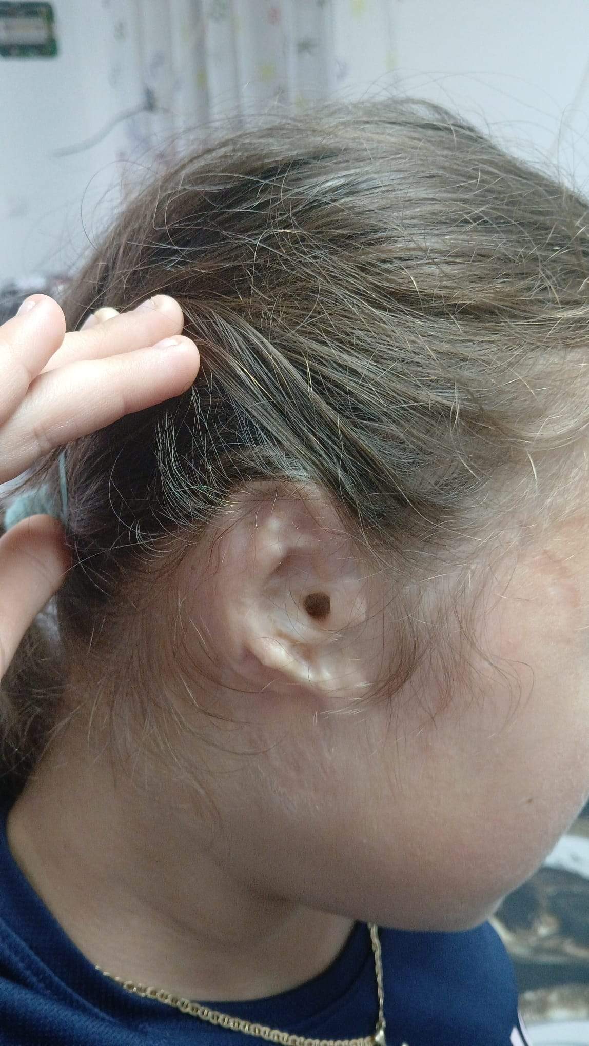 Apel umanitar: Andreea, o fetiță de 11 ani care a fost mutilată de câini, are nevoie de noi pentru a-și reface urechea!