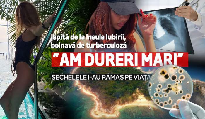Ispită de la Insula Iubirii, bolnavă de turberculoză. ”Am dureri mari”. Sechelele i-au rămas pe viaţă