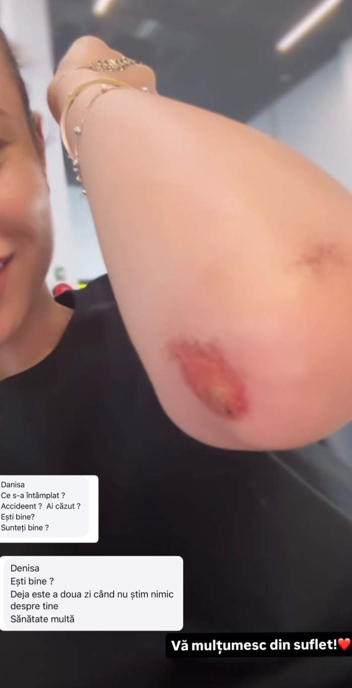 Denisa Filcea, accident la Watersports! Ce mesaj a postat vedeta pe Instagram pentru fani: „Nu pot să-mi ridic mâna”