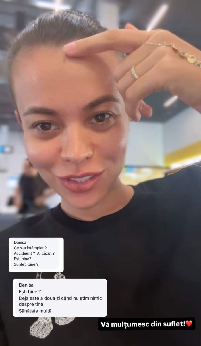 Denisa Filcea, accident la Watersports! Ce mesaj a postat vedeta pe Instagram pentru fani: „Nu pot să-mi ridic mâna”