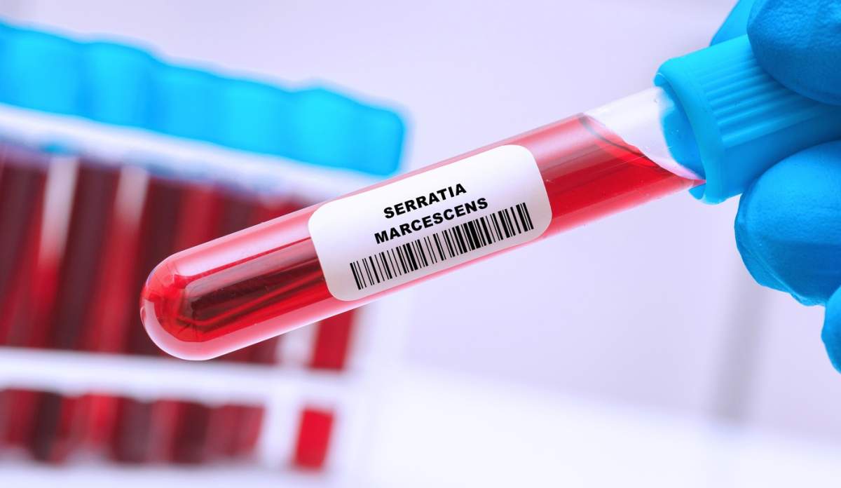 simptomele bacteriei Serratia Marcescens