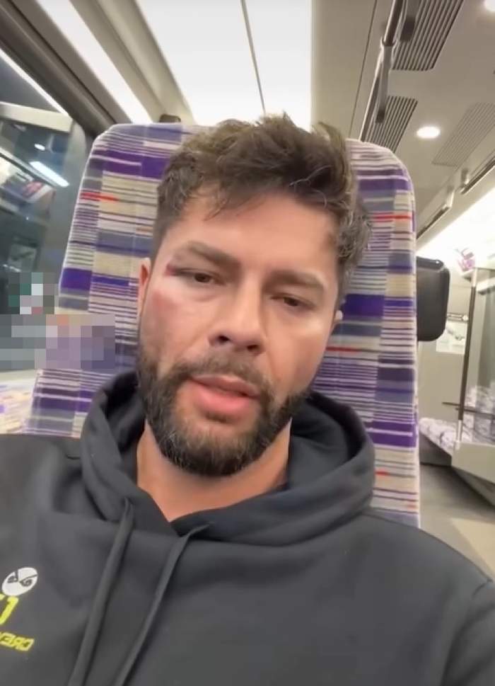 andrew marv in tren dupa ce a fost batut