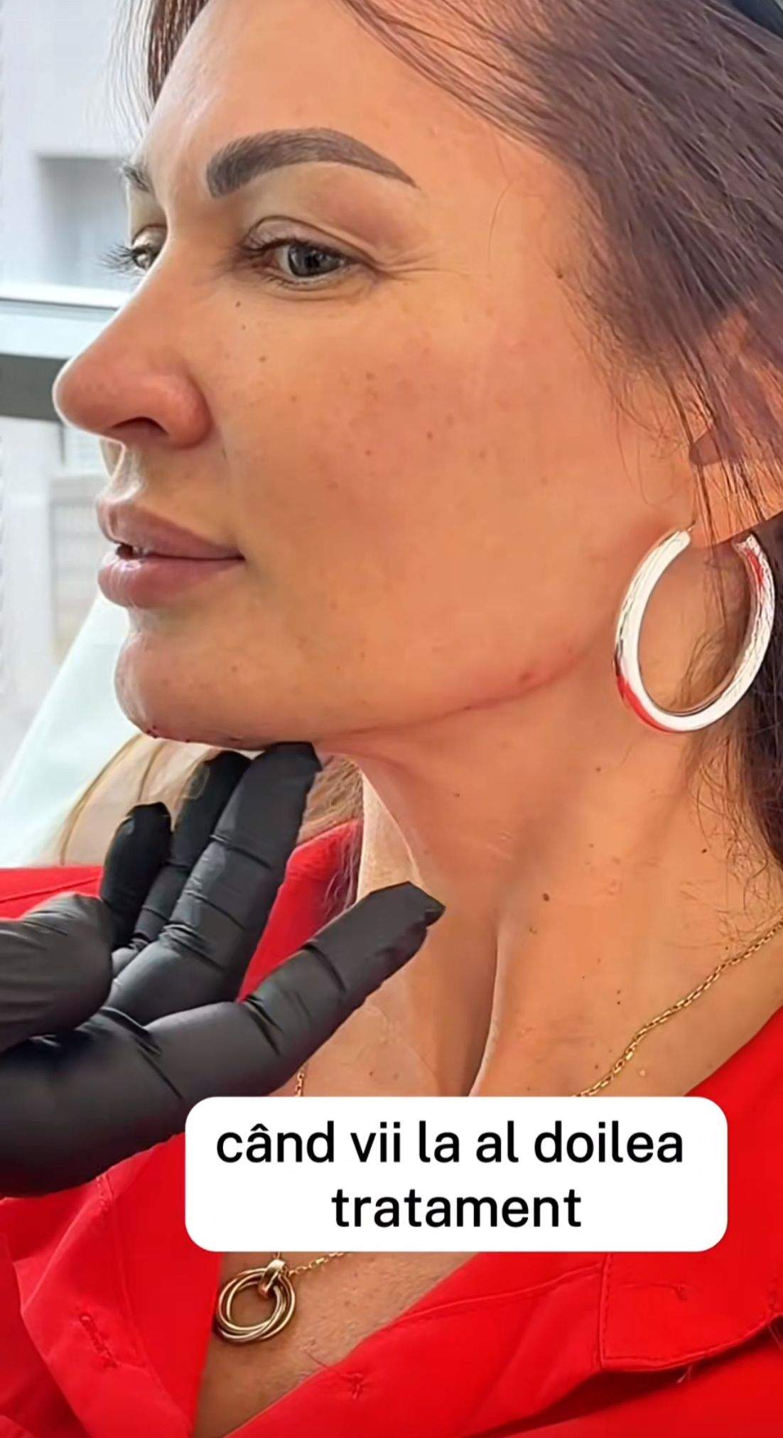 Nicoleta Luciu, pe mâna esteticianului. La ce procedură a apelat actrița | FOTO