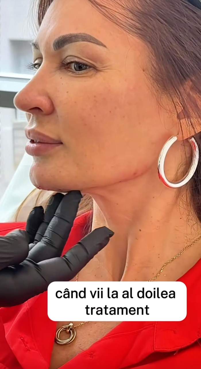 Nicoleta Luciu, pe mâna esteticianului. La ce procedură a apelat actrița | FOTO