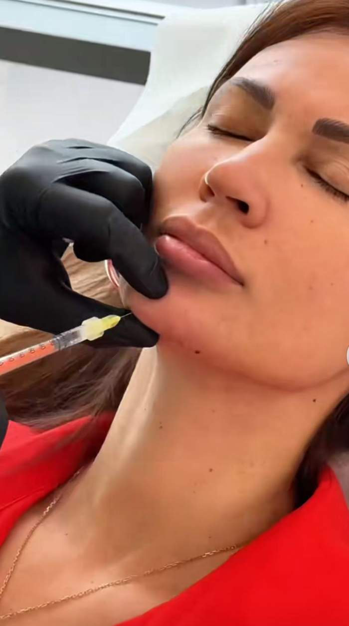 Nicoleta Luciu, pe mâna esteticianului. La ce procedură a apelat actrița | FOTO