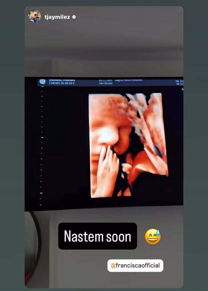 bebelușul Franciscăi și a lui TJ Miles