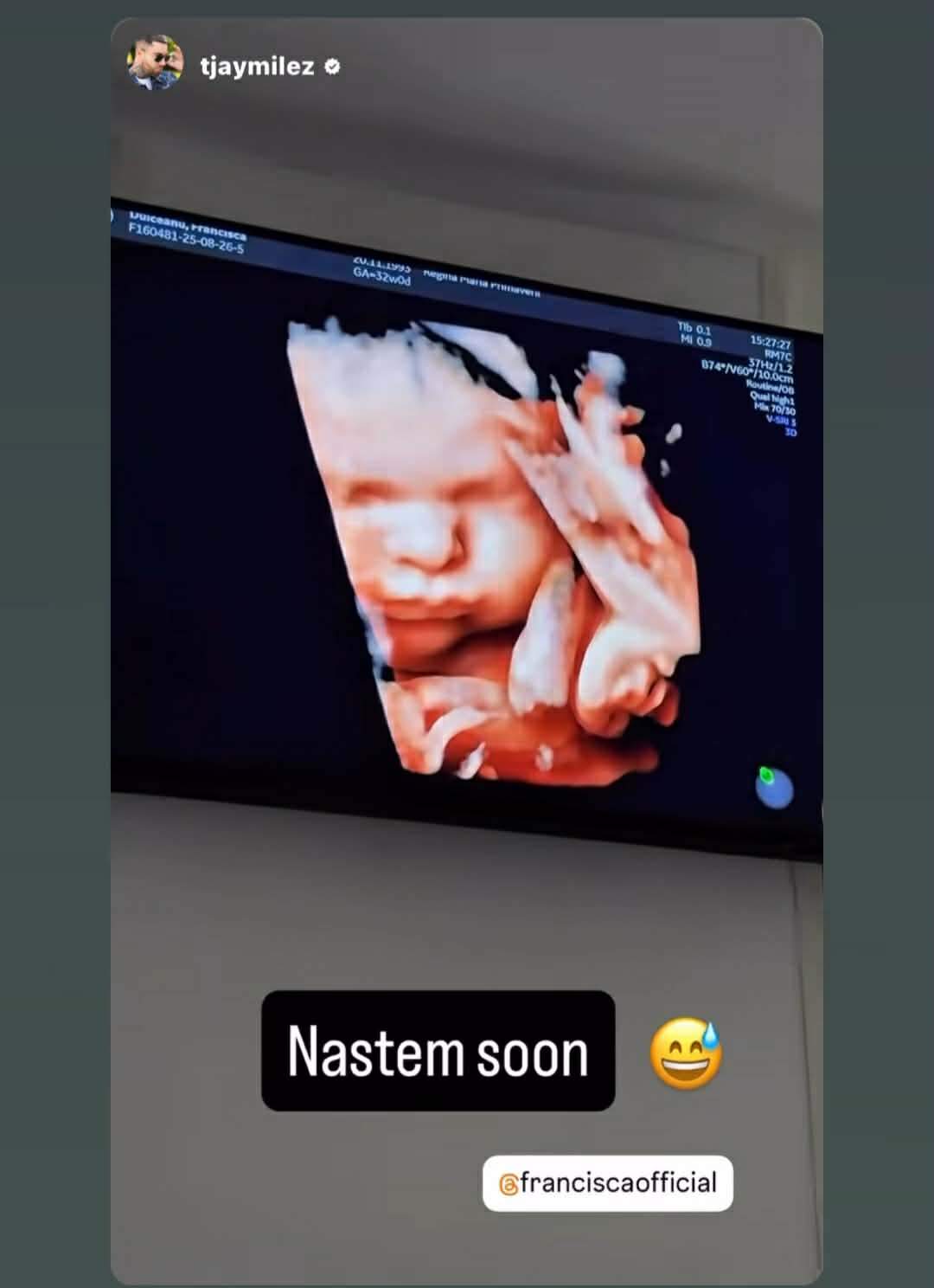 bebelușul Franciscăi și a lui TJ Miles