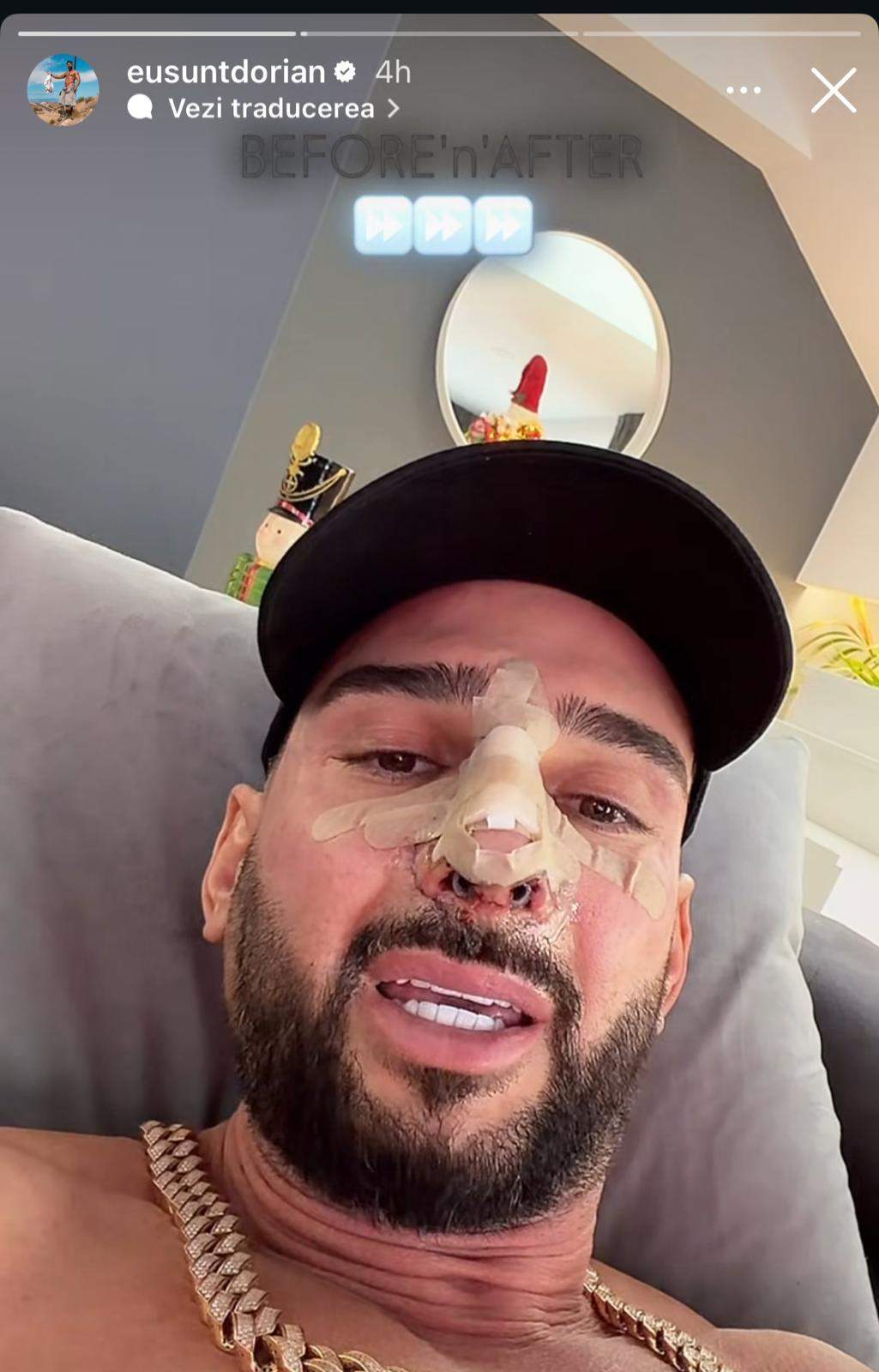 Dorian Popa, declarații exclusive după ce a fost operat! Cum se simte după intervenția chirurgicală care a durat aproape 7 ore