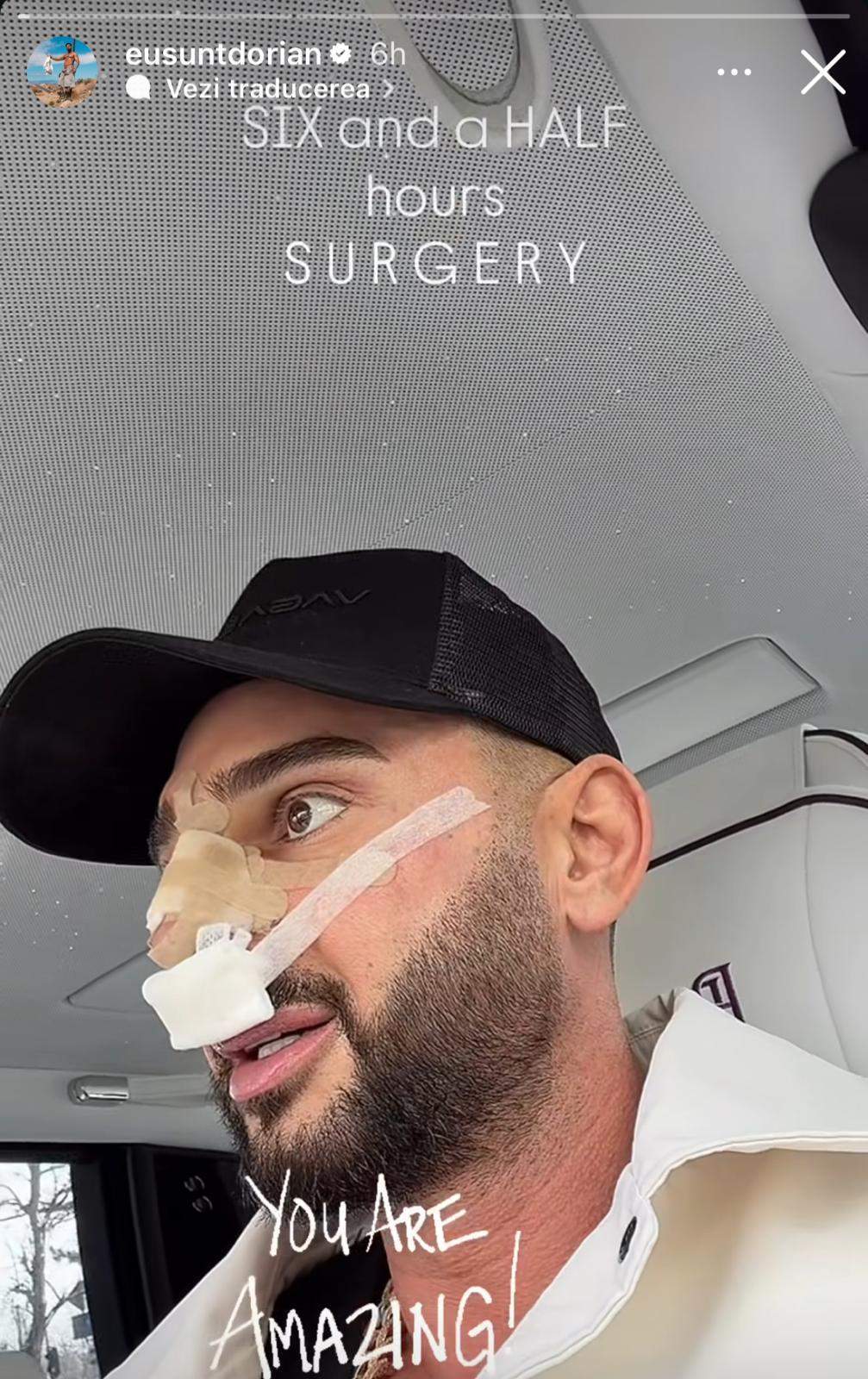 Dorian Popa, declarații exclusive după ce a fost operat! Cum se simte după intervenția chirurgicală care a durat aproape 7 ore
