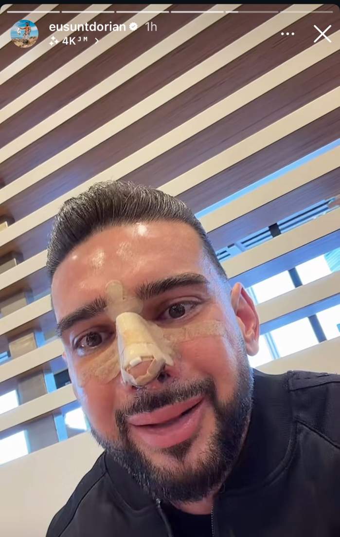 Dorian Popa, operat la nas