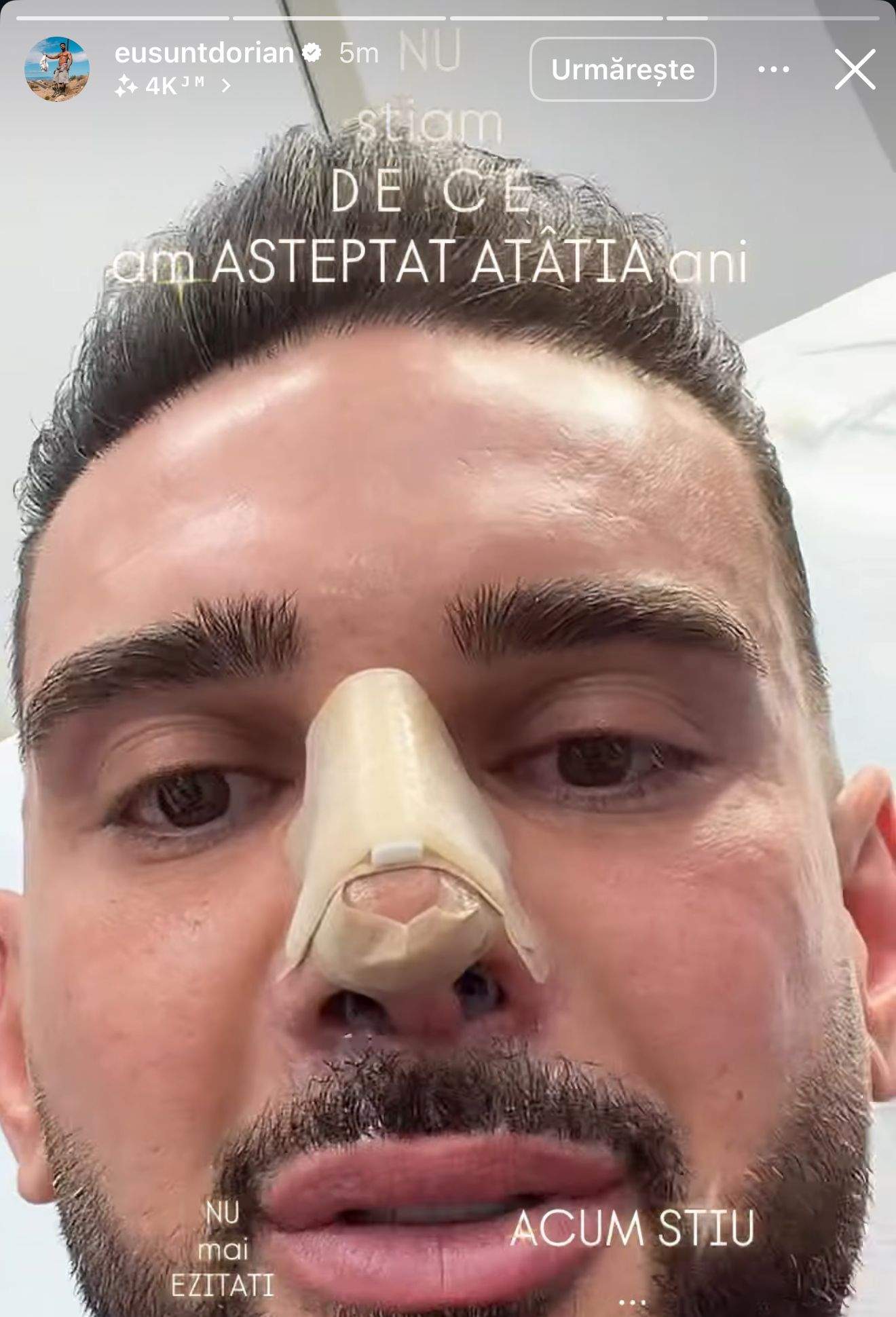 Dorian Popa, operat la nas