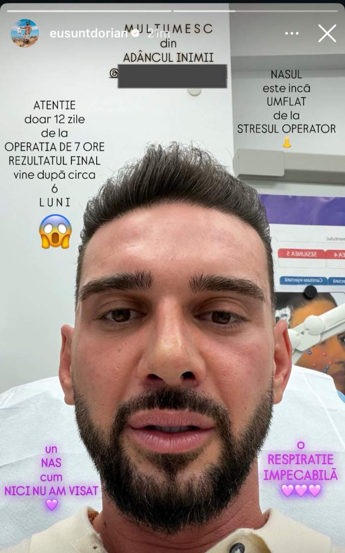 Dorian Popa, după operație