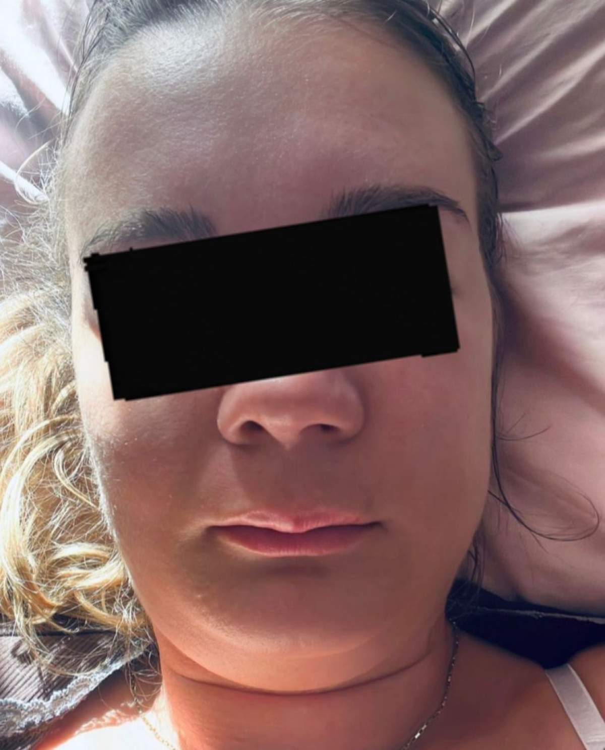 Femeia din Brașov, cu fața umflată