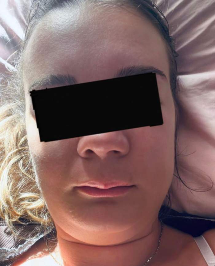 Femeia din Brașov, cu fața umflată