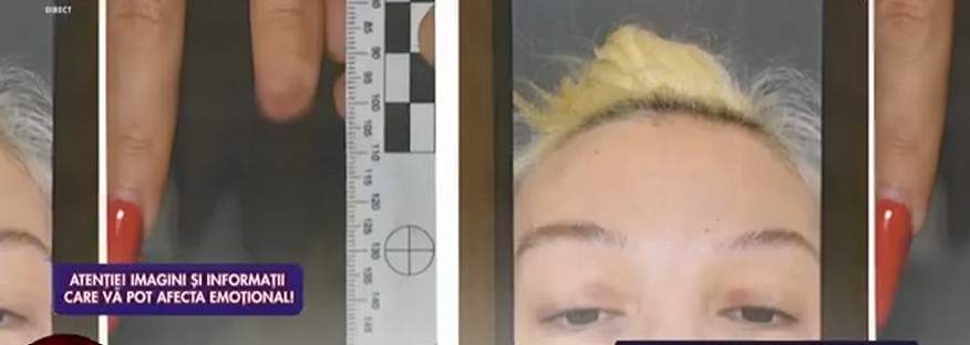Dosarul în care Ema Uta își acuză fostul iubit de agresiune. Ce a declarat make-up artista la poliție