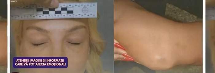 Dosarul în care Ema Uta își acuză fostul iubit de agresiune. Ce a declarat make-up artista la poliție
