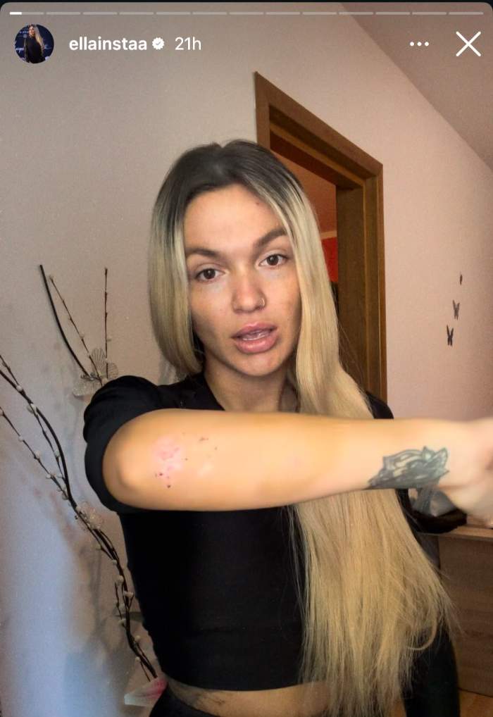 Ella Vișan, accidentată