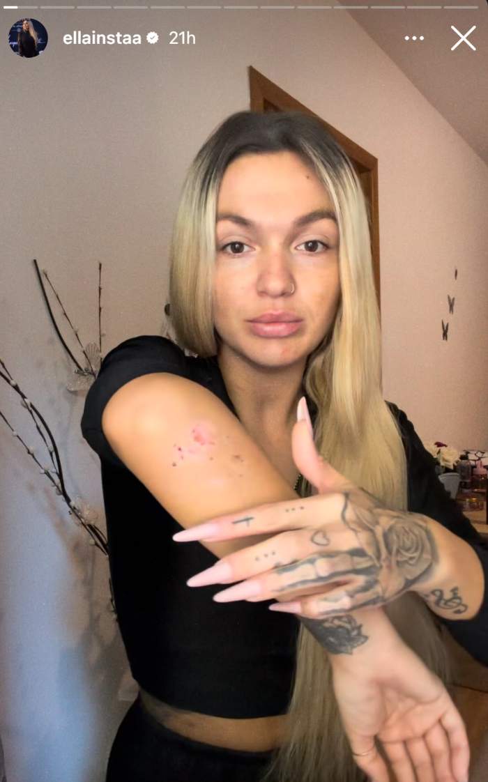 Ella Vișan, accidentată
