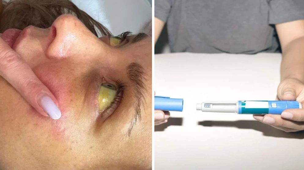 O femeie a ajuns la insuficiență hepatică după ce a făcut injecții pentru slăbit! A folosit o substanță cumpărată ilegal