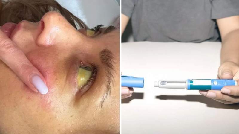 O femeie a ajuns la insuficiență hepatică după ce a făcut injecții pentru slăbit! A folosit o substanță cumpărată ilegal