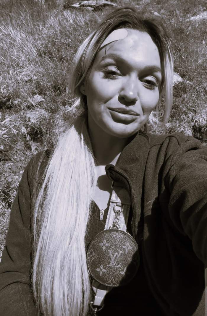 Ella Vișan, implicată într-un accident cumplit! A căzut de pe munte și s-a ales cu răni grave pe față: ”Sunt julită peste tot”