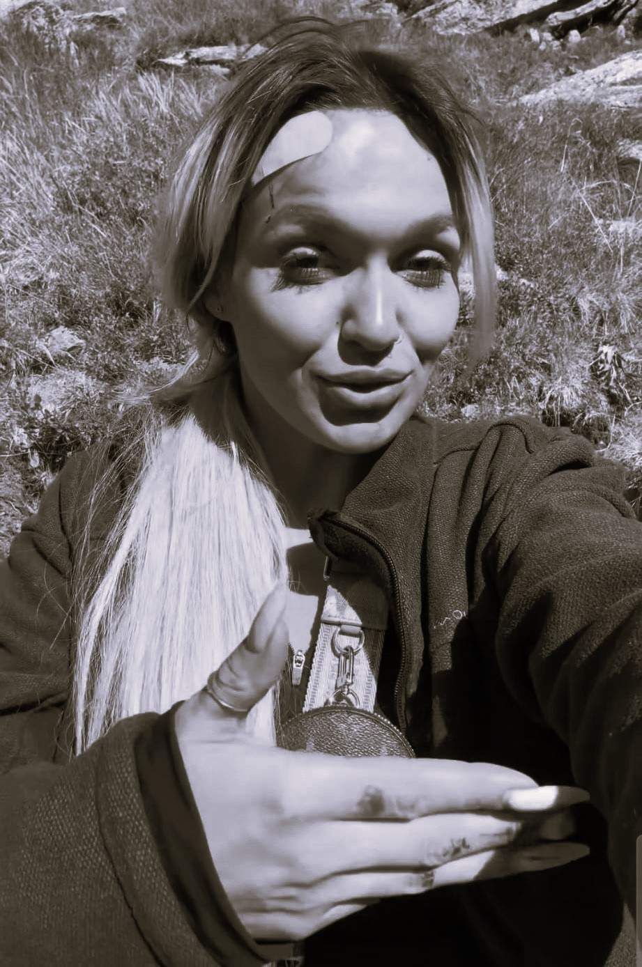 Ella Vișan, implicată într-un accident cumplit! A căzut de pe munte și s-a ales cu răni grave pe față: ”Sunt julită peste tot”