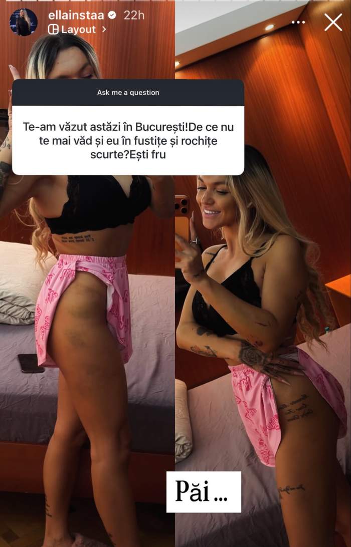 Ella Vișan, plină de vânătăi