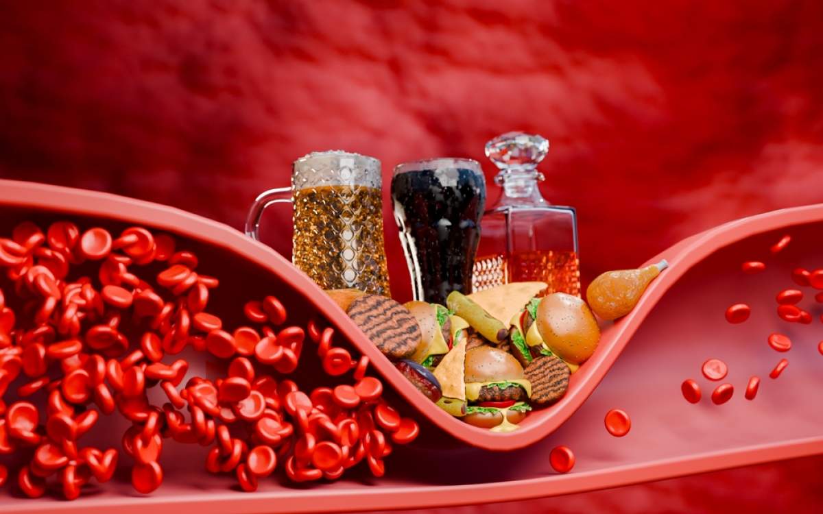 (P) Legătura dintre stilul de viață și valorile trigliceridelor 