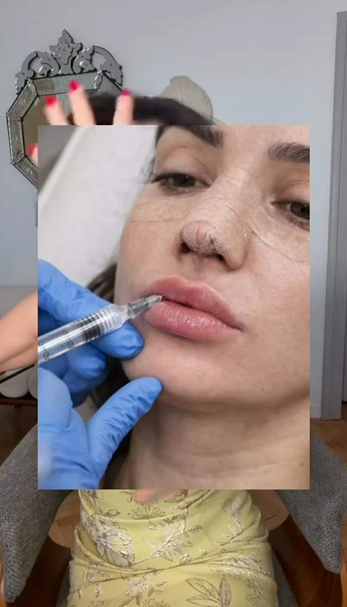 Ana Morodan recunoaște că nu mai e naturală! Ce intervenții are influencerița