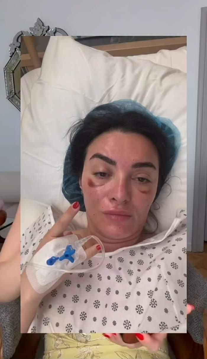 Ana Morodan recunoaște că nu mai e naturală! Ce intervenții are influencerița