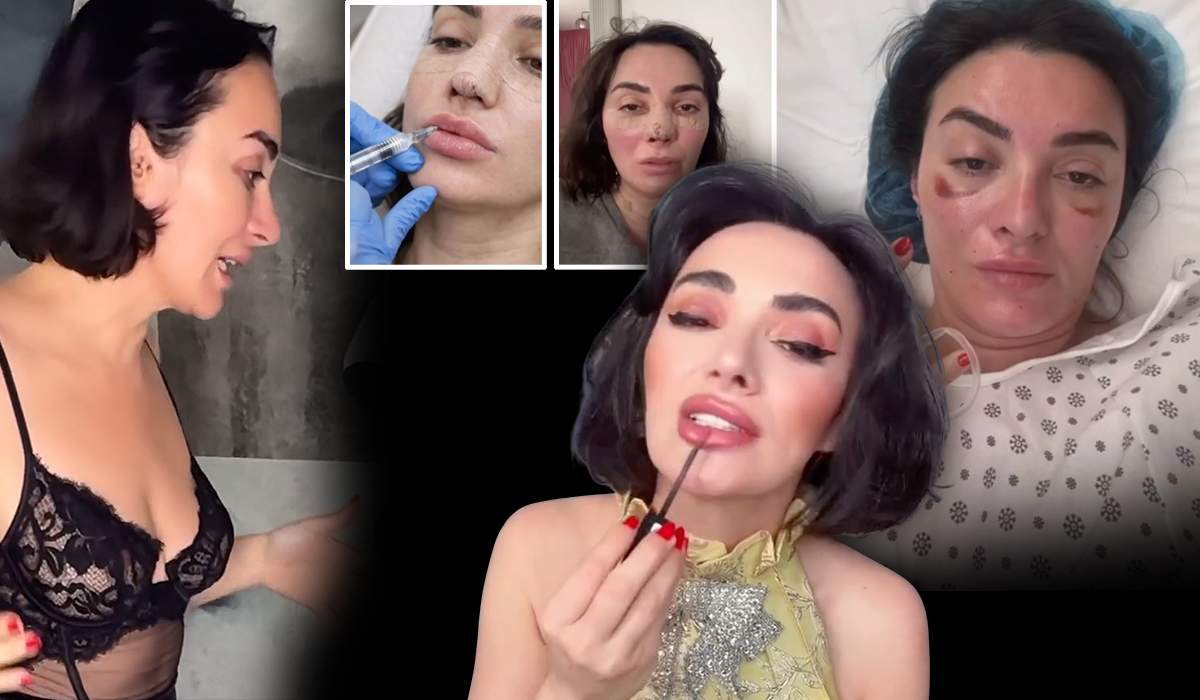 Ana Morodan recunoaște că nu mai e naturală! Ce intervenții are influencerița