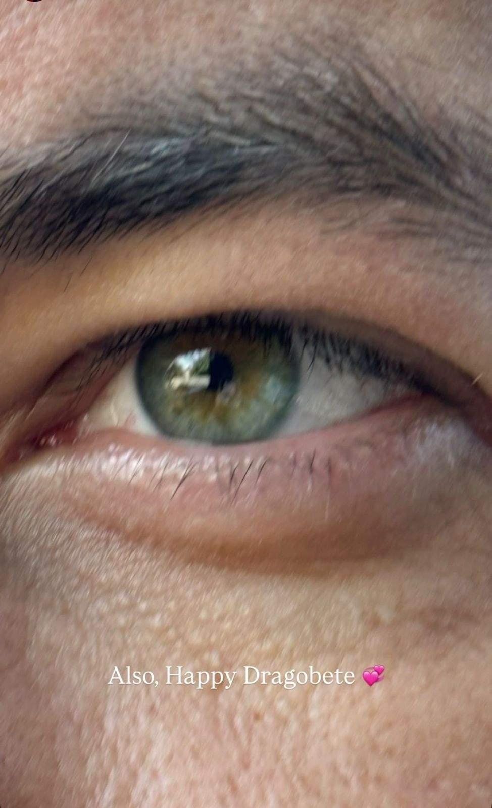 Ochiul iubitului Ioanei Grama