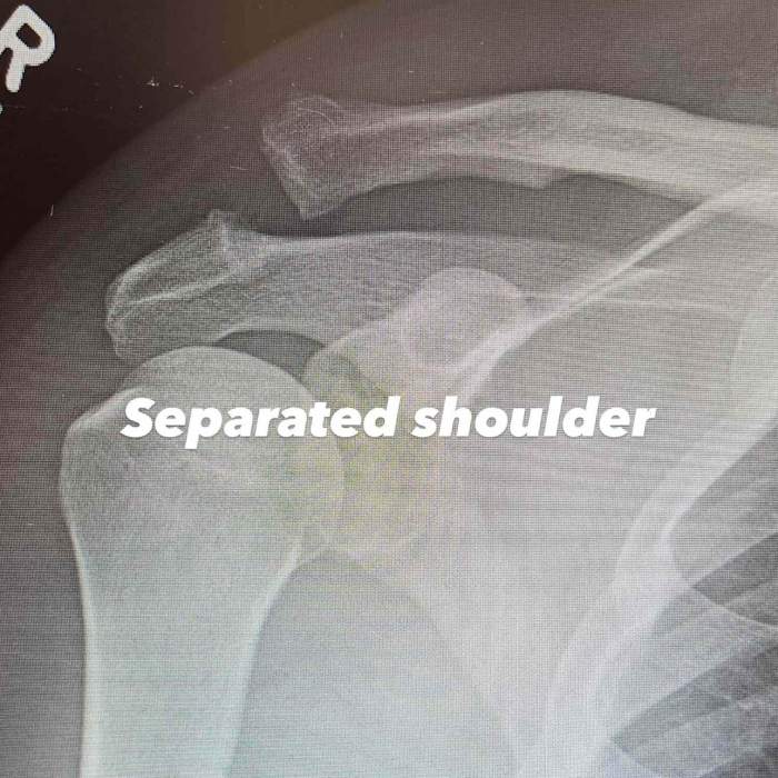 radiografia lui Channing Tatum