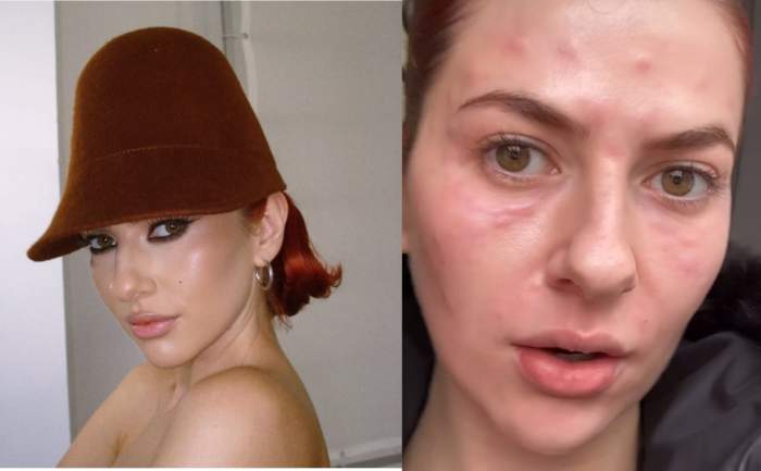 Colaj cu Lidia Buble