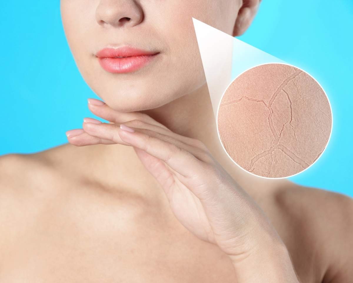 O femeie cu ten uscat care a aplicat machiaj