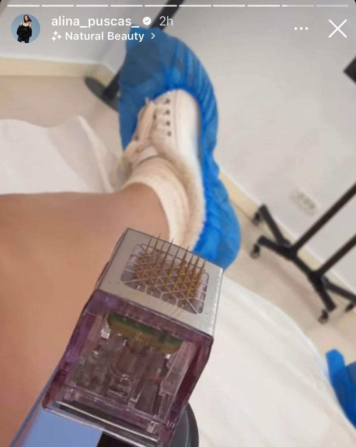 Piciorul Alinei Pușcaș