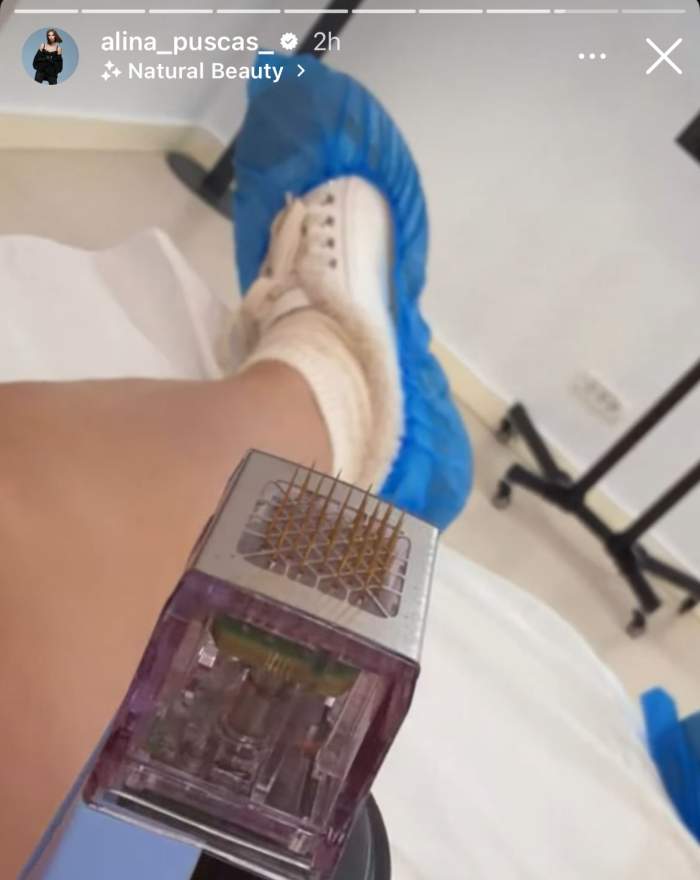 Piciorul Alinei Pușcaș