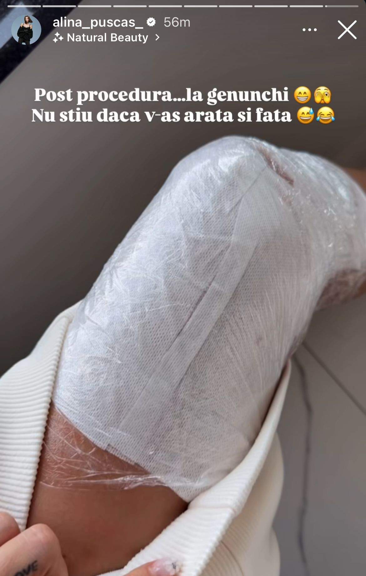 Piciorul Alinei Pușcaș