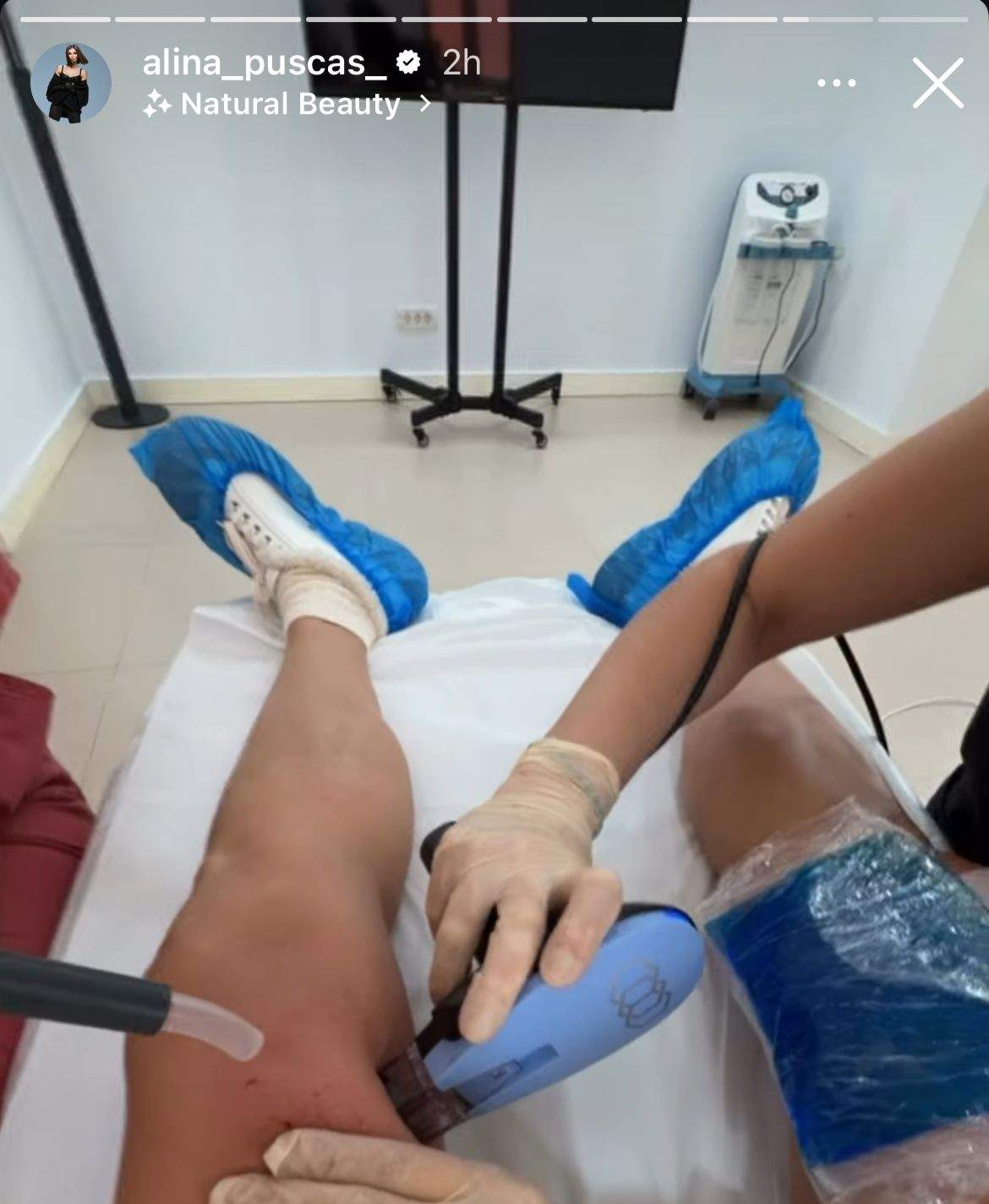 Picioarele Alinei Pușcaș