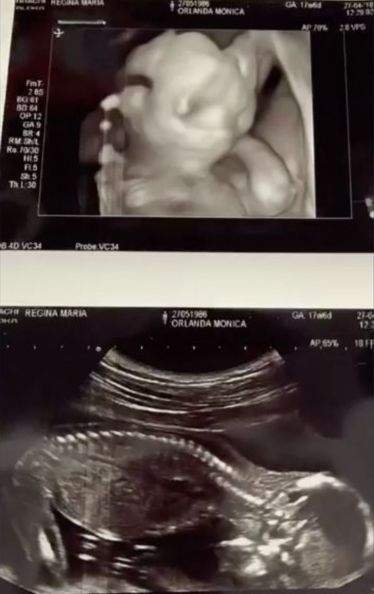 Ecografia Monicăi Orlanda