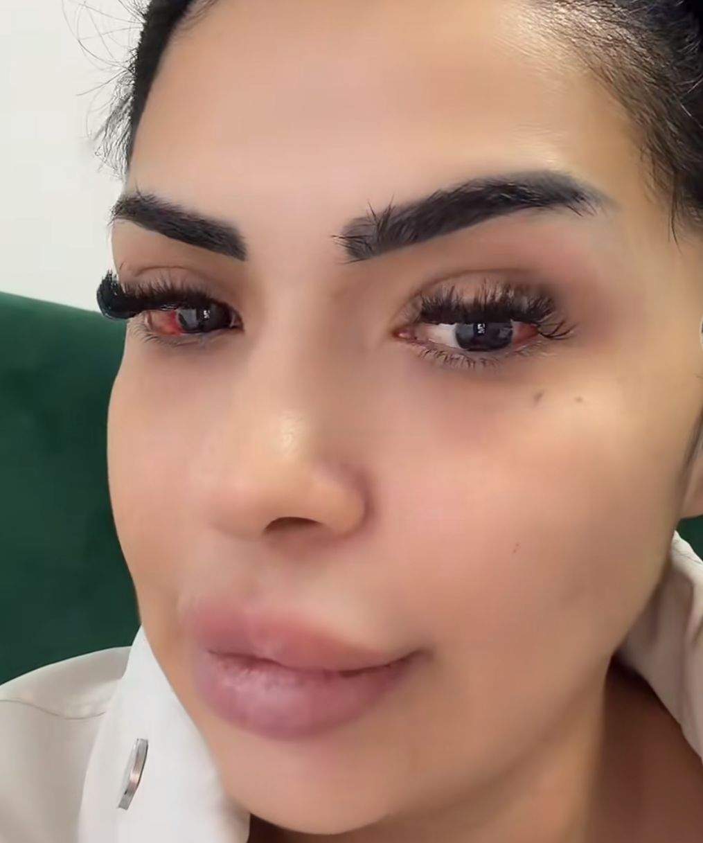 Raluca Drăgoi, afectată