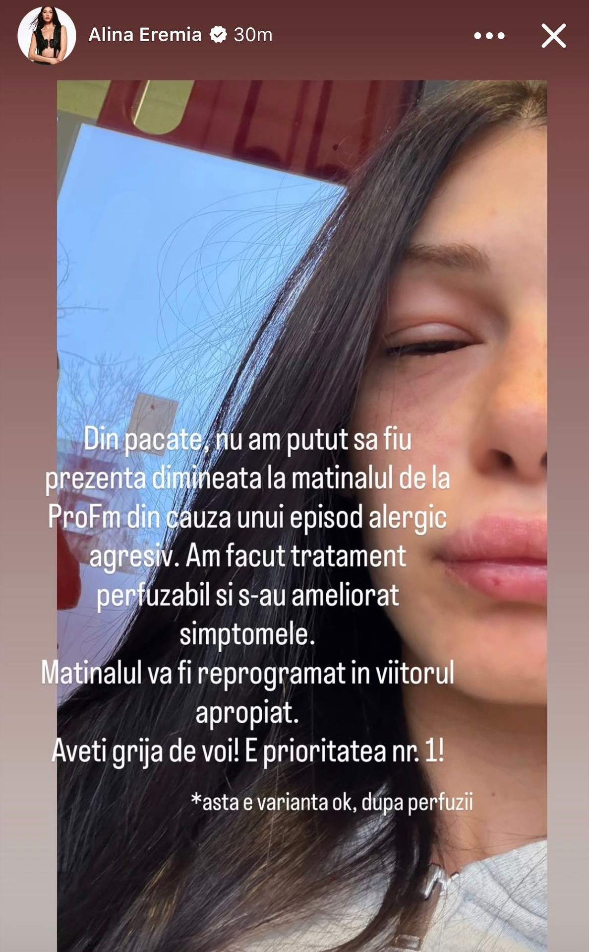 Alina Eremia cu fața tumefiată