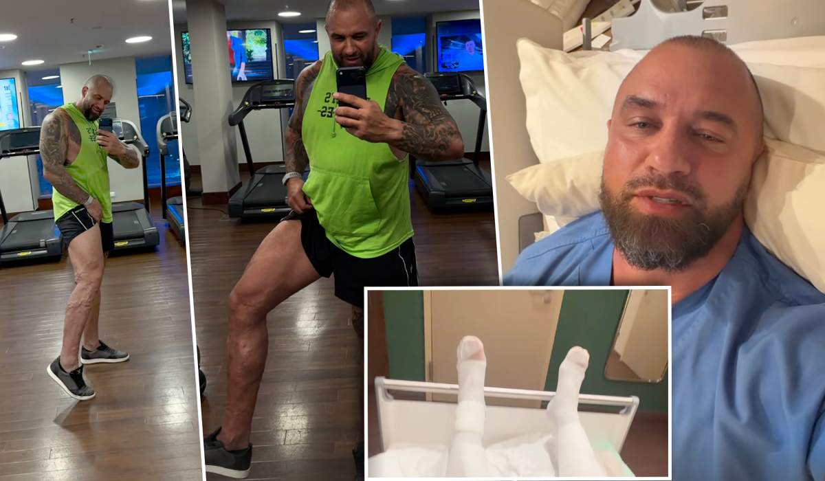 Alex Bodi, declarații exclusive pentru Spynews.ro, după operația la ambele picioare!