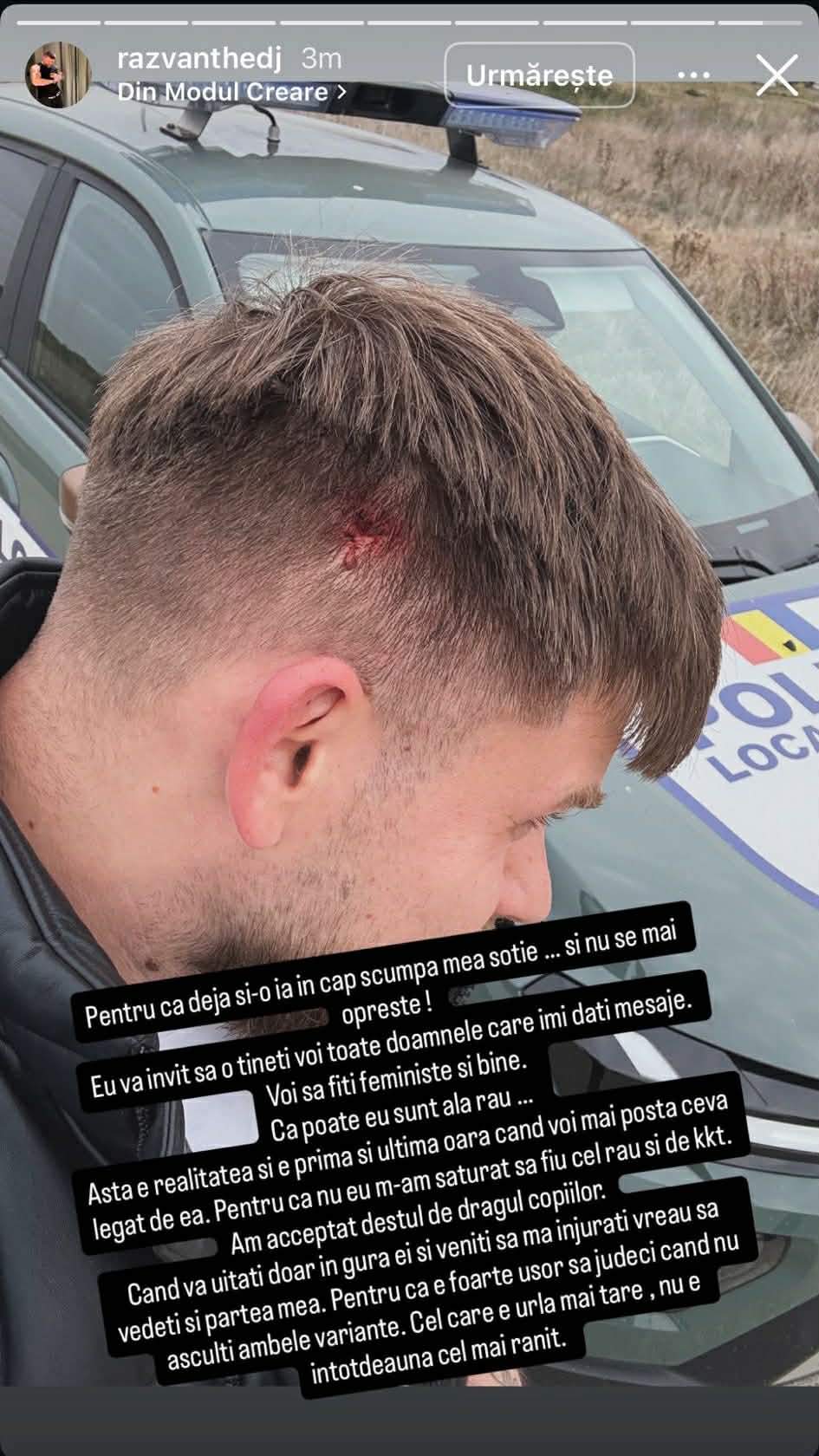 Răzvan Kovacs, acuzații șoc la adresa fostei soții! Susține că Ema Oprișan l-a rănit și prezintă dovezi