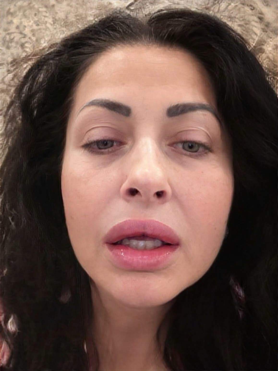 Gabriela Cristea, cu fața umflată