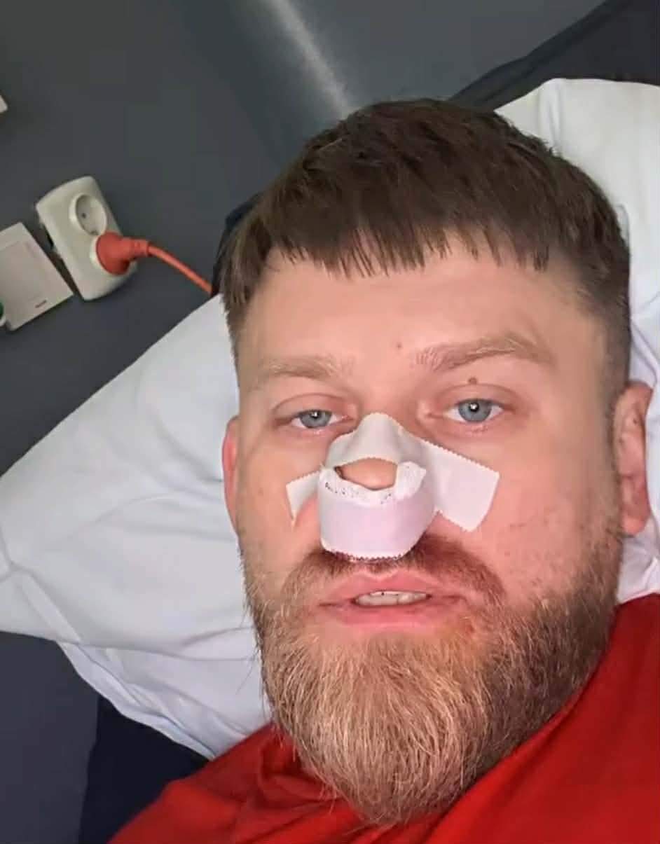 Răzvan Kovacs operat