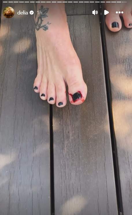 Delia Matache, accident casnic! Cât de rău s-a lovit artista